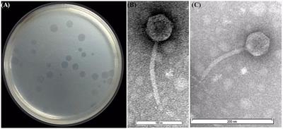 Genomic and Proteomic Characterizations of Sfin-1, a Novel Lytic Phage Infecting Multidrug-Resistant Shigella spp. and Escherichia coli C
